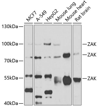 ZAK Polyclonal Antibody