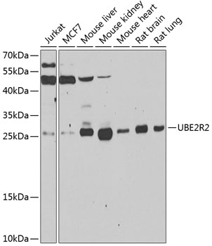 UBE2R2 Polyclonal Antibody