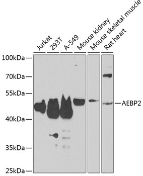 AEBP2 Polyclonal Antibody&nbsp;<img src="images/icon_newarrival.gif" alt="new" border="0">