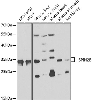 SPIN2B Polyclonal Antibody