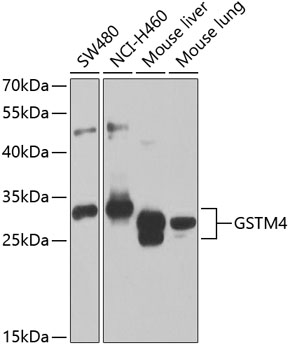 GSTM4 Polyclonal Antibody