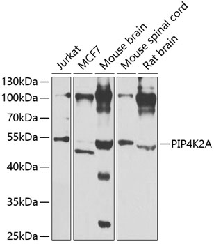 PIP4K2A Polyclonal Antibody