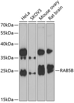 RAB5B Polyclonal Antibody