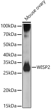 WISP2 Polyclonal Antibody