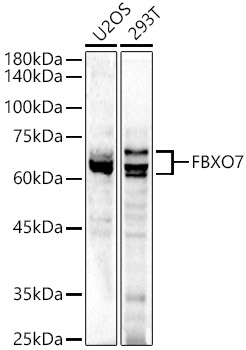 FBXO7 Polyclonal Antibody