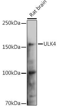 ULK4 Polyclonal Antibody