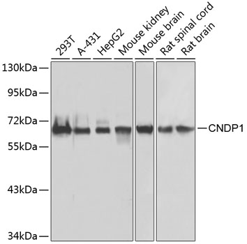CNDP1 Polyclonal Antibody