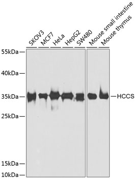 HCCS Polyclonal Antibody