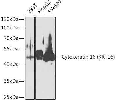 Cytokeratin 16 (KRT16) Polyclonal Antibody