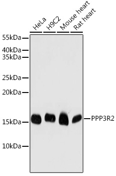 PPP3R2 Polyclonal Antibody