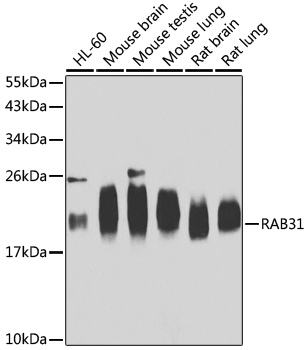 RAB31 Polyclonal Antibody