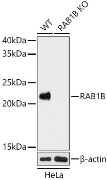 RAB1B Polyclonal Antibody