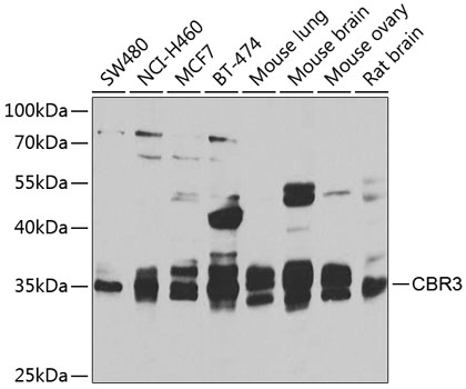 CBR3 Polyclonal Antibody
