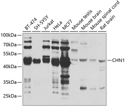 CHN1 Polyclonal Antibody
