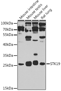 STK19 Polyclonal Antibody