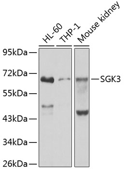 SGK3 Polyclonal Antibody