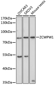 ZCWPW1 Polyclonal Antibody