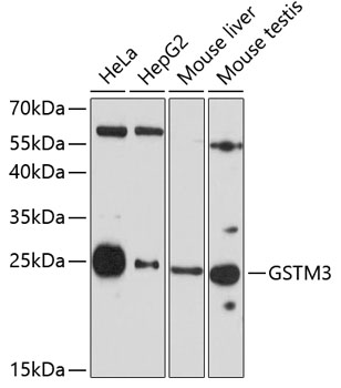 GSTM3 Polyclonal Antibody