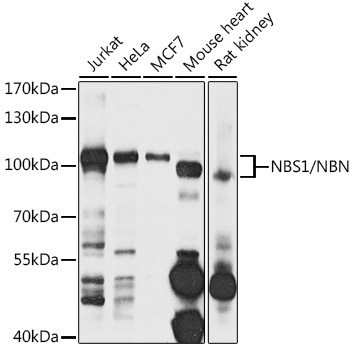 NBS1/NBN Polyclonal Antibody
