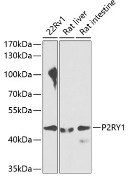 P2RY1 Polyclonal Antibody