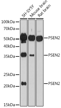 PSEN2 Polyclonal Antibody