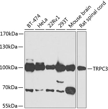 TRPC3 Polyclonal Antibody