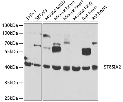 ST8SIA2 Polyclonal Antibody