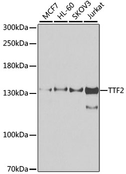 TTF2 Polyclonal Antibody