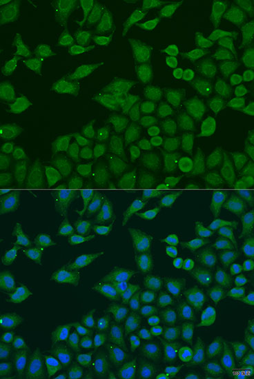 PLA2G4C Polyclonal Antibody
