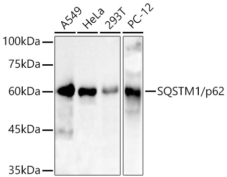 SQSTM1/p62 Polyclonal Antibody