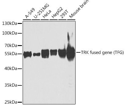 TRK fused gene (TFG) Polyclonal Antibody