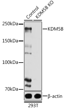 KDM5B Polyclonal Antibody