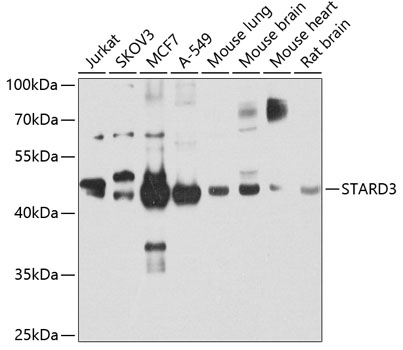 STARD3 Polyclonal Antibody