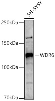 WDR6 Polyclonal Antibody