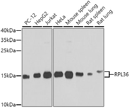 RPL36 Polyclonal Antibody