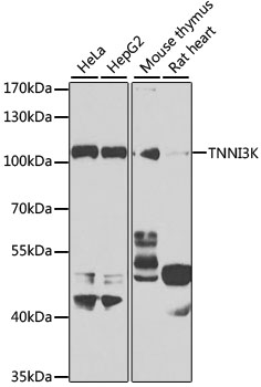 TNNI3K Polyclonal Antibody