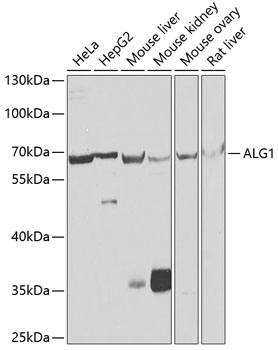 ALG1 Polyclonal Antibody