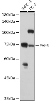 PAK6 Polyclonal Antibody