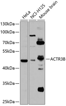 ACTR3B Polyclonal Antibody&nbsp;<img src="images/icon_newarrival.gif" alt="new" border="0">