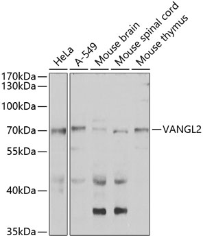 VANGL2 Polyclonal Antibody