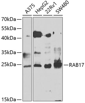 RAB17 Polyclonal Antibody