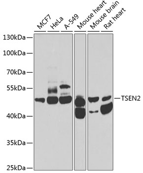 TSEN2 Polyclonal Antibody