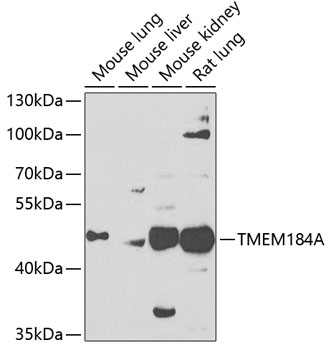 TMEM184A Polyclonal Antibody