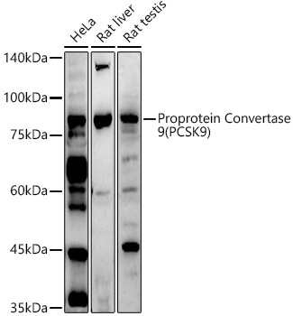 Proprotein Convertase 9(PCSK9) Polyclonal Antibody