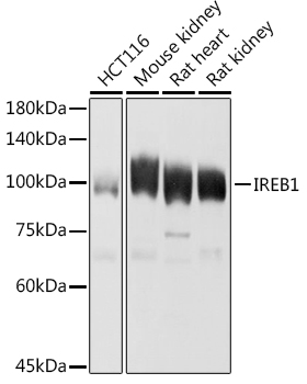 Aconitase 1 (ACO1) Polyclonal Antibody&nbsp;<img src="images/icon_newarrival.gif" alt="new" border="0">