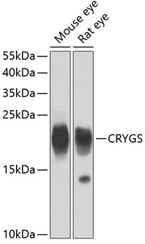 CRYGS Polyclonal Antibody