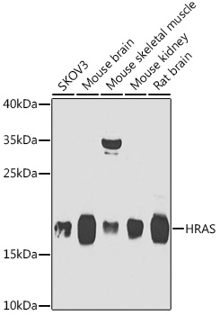 HRAS Polyclonal Antibody