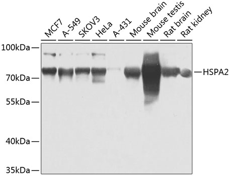 HSPA2 Polyclonal Antibody