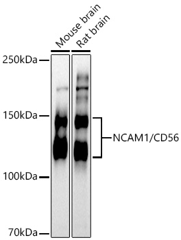 NCAM1 / CD56 Polyclonal Antibody