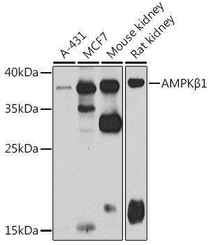 AMPKB1 Polyclonal Antibody
